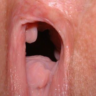 SexMachine anal Model - SexMachine anal