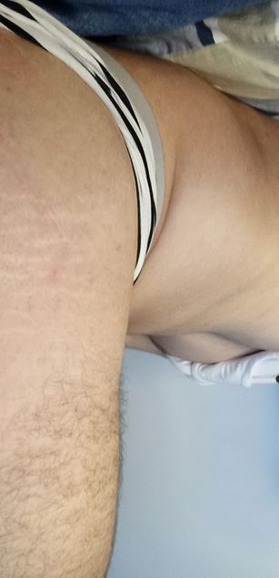 Axel Rous ass Model - Axel Rous ass