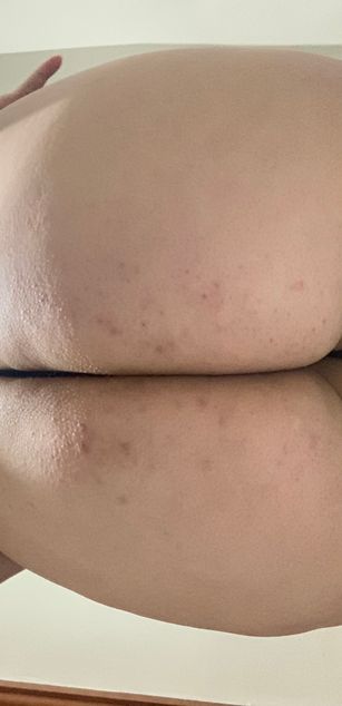 Madison Rogers bigtits Model - Madison Rogers bigtits