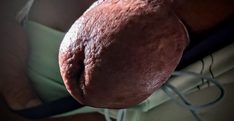 Profile picture - StoneyBurnside