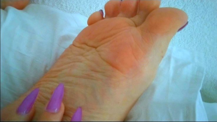 Moisturising my tiny feet with lots of German