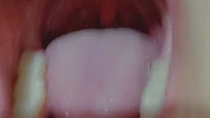 Teeth, tongue, tongue veins, throat, uvula, and to