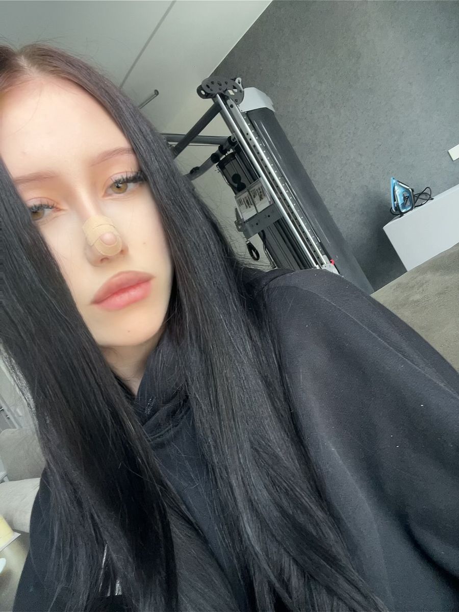 Yukimi