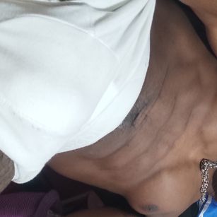 Model - Kobe Smith hairy