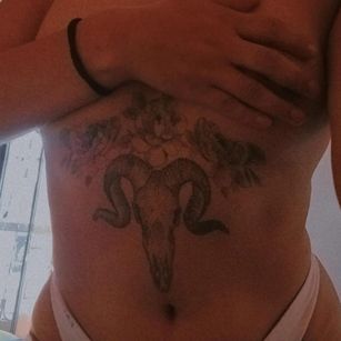 Model - Olivia braces