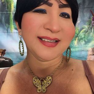 Model - XIOMY_TS anal