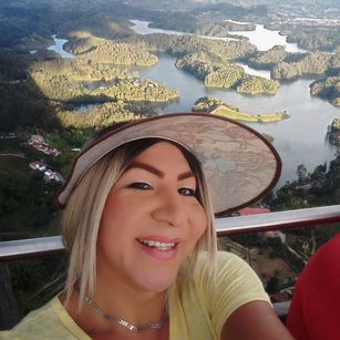 Model - XIOMY_TS anal