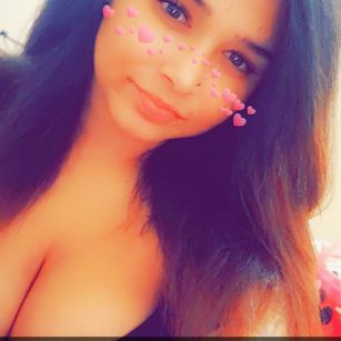 Model - Beautyv freckles