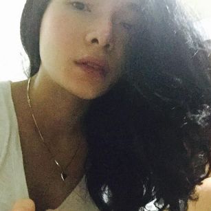 Model - QueenKendall preop