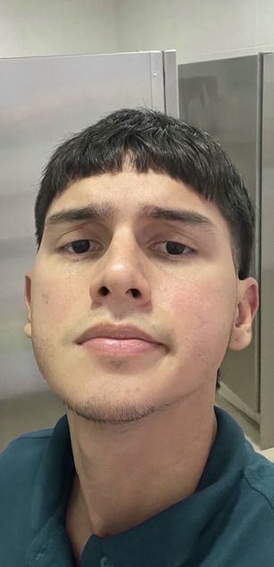 Model - Seth Retts hairy