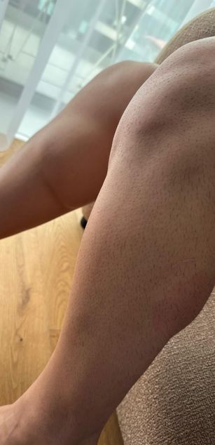 Model - MassiveKonstantin feet