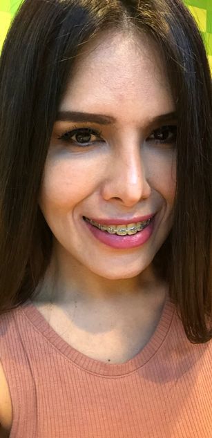 Model - MadocVentura striptease