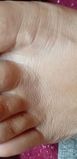 Model - loingoio hairy