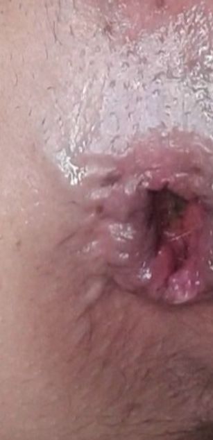 Model - loingoio hairy