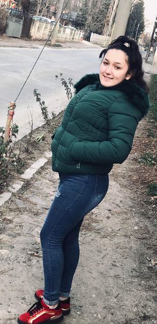 Model - CassiaTrace lips