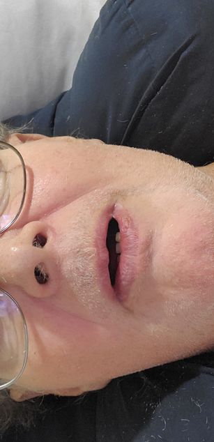 Model - Fatoldster oral