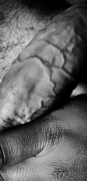 Model - Mr Veins couple