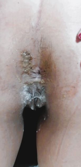 Model - AngelyDirtySquirt deepthroat