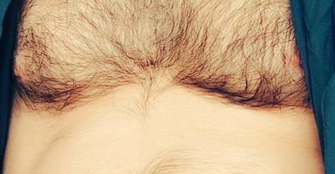 Profile picture - roaringkitty