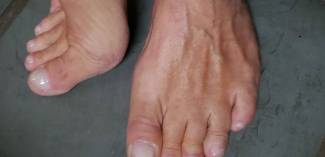 Model - CaryGranite mature