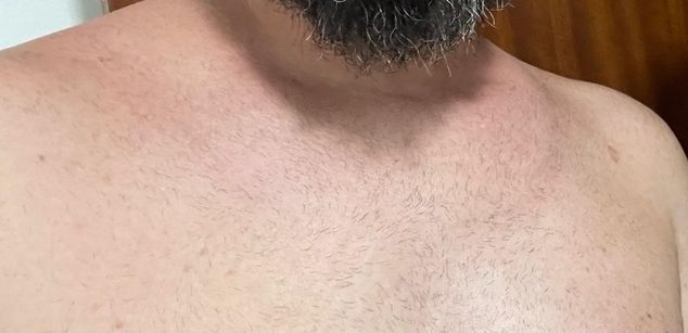 Model - Casadosafado exibicionismo