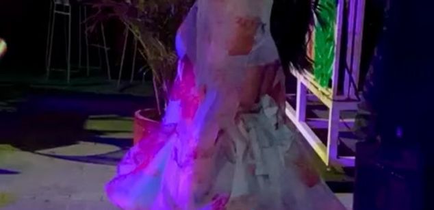 Model - Chantal Labiogruesos