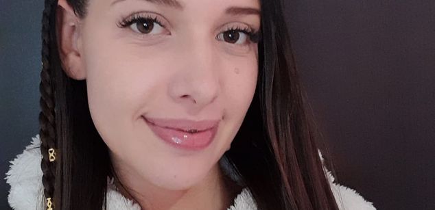 Model - OrianaFer braces