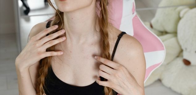 Model - Megan Elfie young