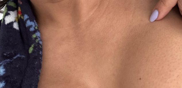 Model - Yanira boobs