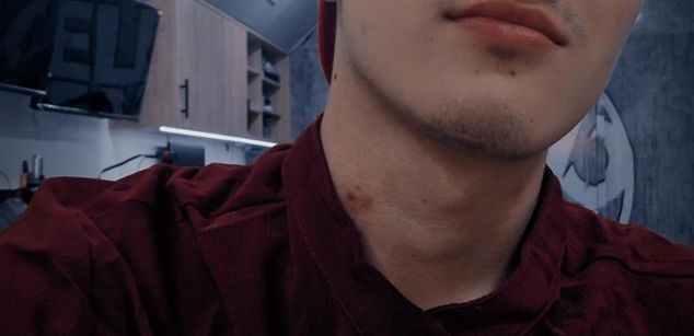 Model - jack_hotson oral