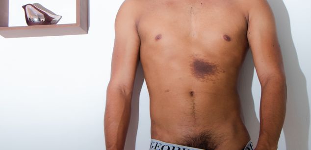 Model - Antoigne spit