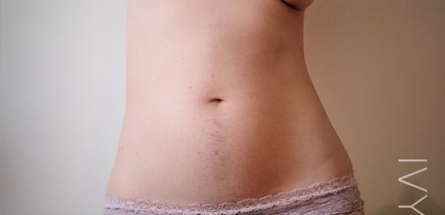 Model - IvyBerry sph