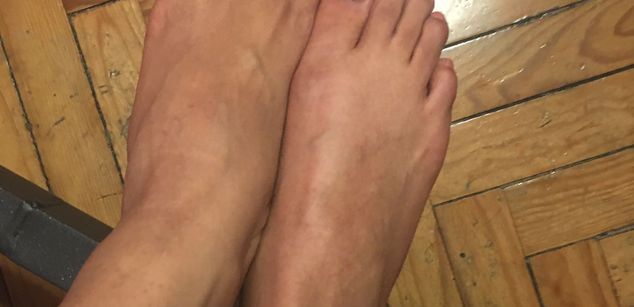 Model - Melii delgadas