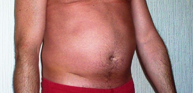 Model - EdwardEngland 7