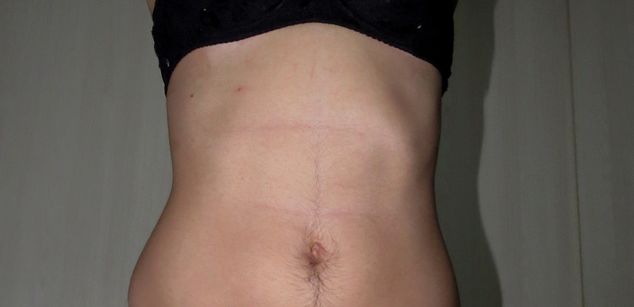 Model - HairyDani hairyarmpits