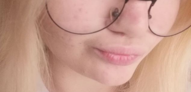 Model - Alice White Bunny cameltoe