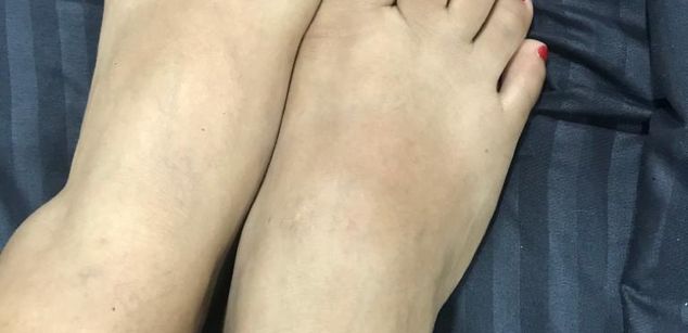 Model - Abby Marshall joi