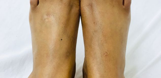 Model - Bustyzii spankass