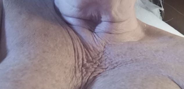 Model - Granny Edith Smith fastresponse