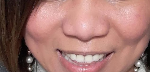 Model - EmmaLovelyMoon mature